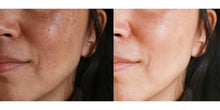 Load image into Gallery viewer, Azelaic Acid Powder Cosmetics Grade - For Skin Face Anti-inflammatory
